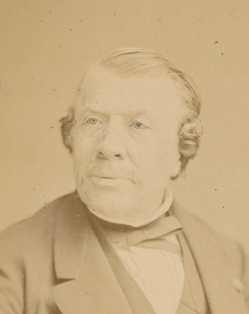 Philippe RICORD par TRINQUART albumine médecin chirurgien retouche photo