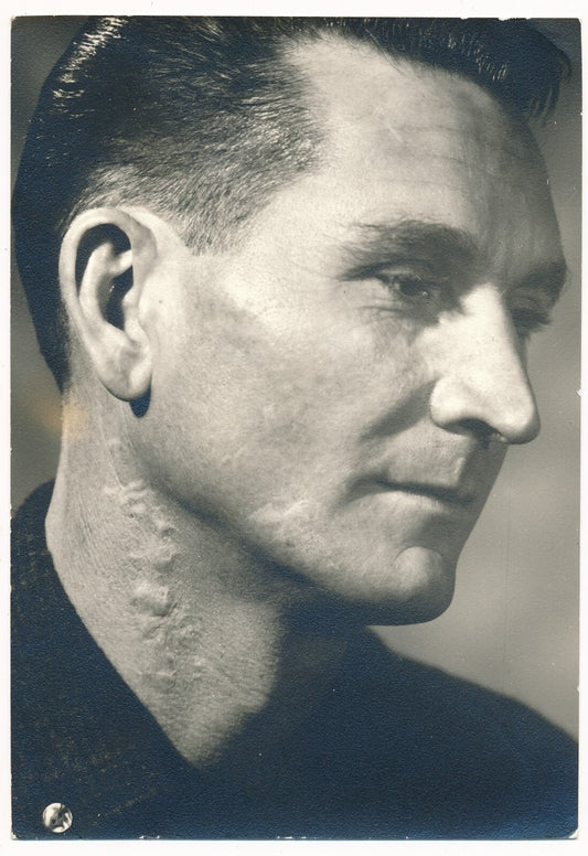 Portrait homme avec cicatrice photo photographie